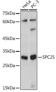 SPC25 Antibody