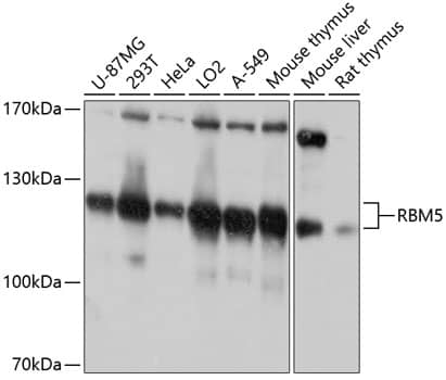 RBM5 Antibody