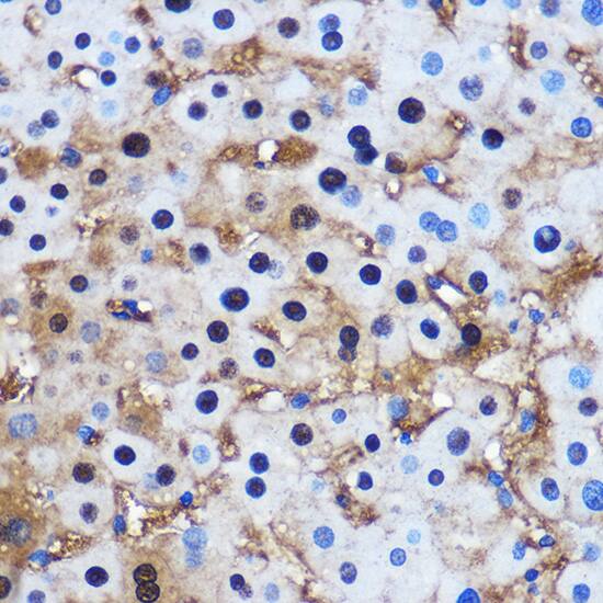 Protein Phosphatase 1 beta Antibody