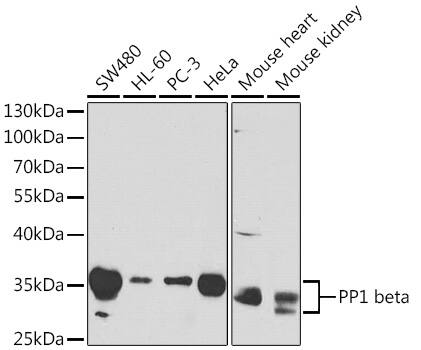 Protein Phosphatase 1 beta Antibody