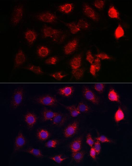 SERCA2 ATPase Antibody
