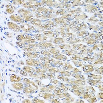 RAC2 Antibody