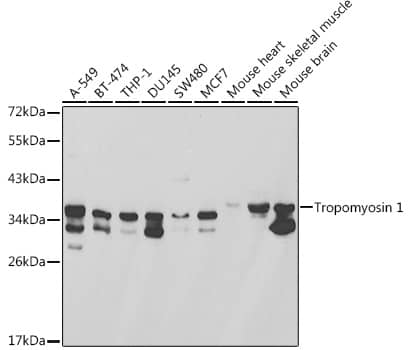 Tropomyosin-1 Antibody