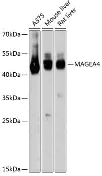 MAGEA4 Antibody