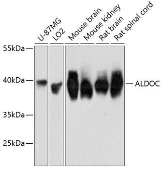 Aldolase C Antibody