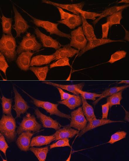 Aldolase C Antibody