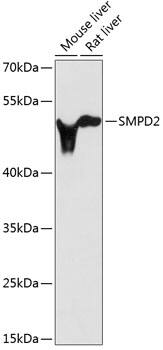 nSMase Antibody