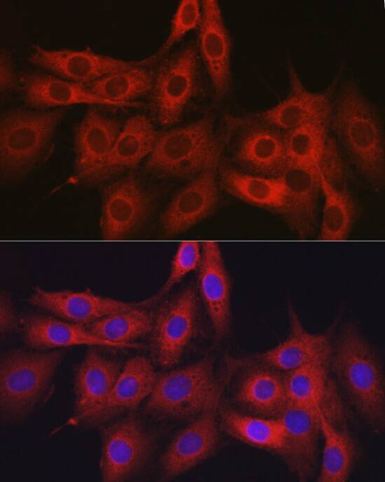 GTPBP9 Antibody