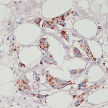 ACSL3 Antibody