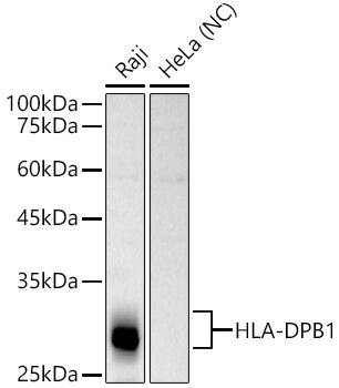 HLA DPB1 Antibody