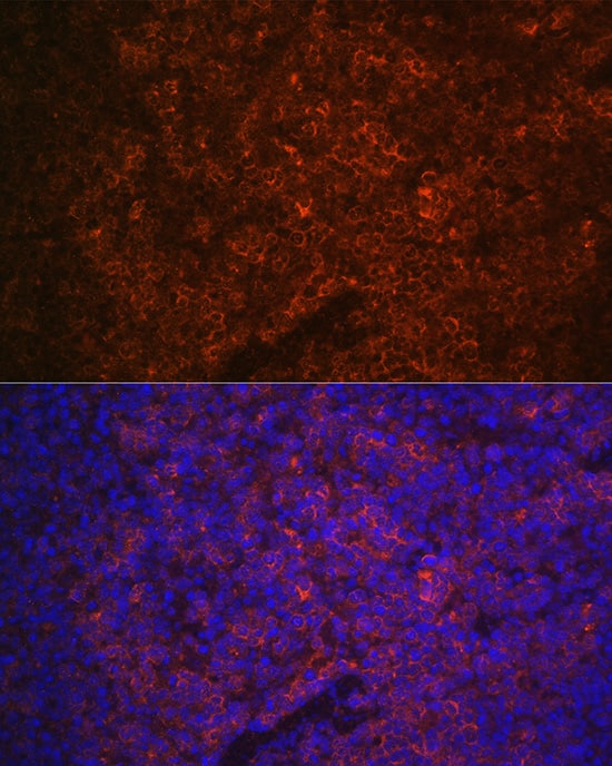 P2X5/P2RX5 Antibody