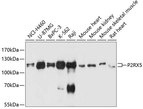 P2X5/P2RX5 Antibody