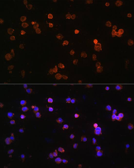 P2X5/P2RX5 Antibody