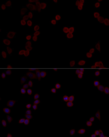 PP5 Antibody