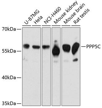 PP5 Antibody