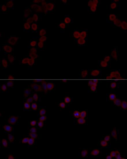 PP5 Antibody