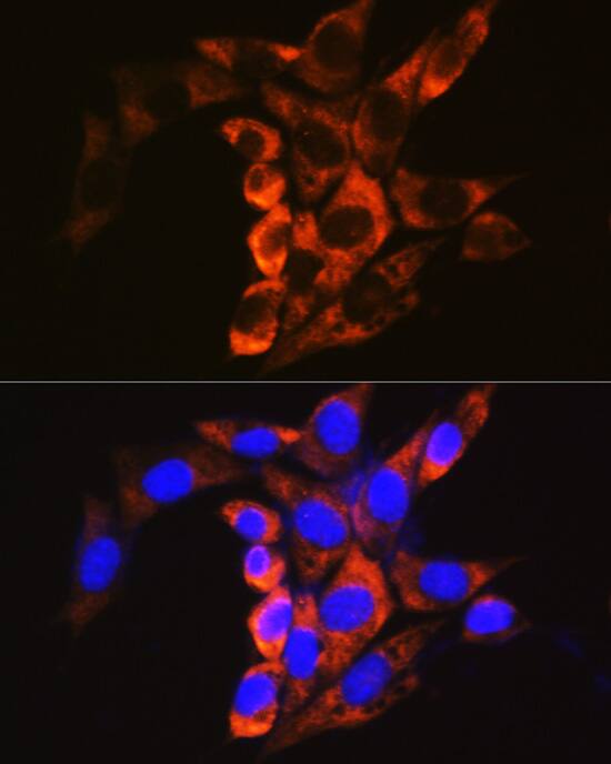 Calpain 1 Antibody