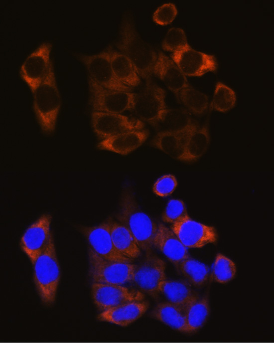 Calpain 1 Antibody