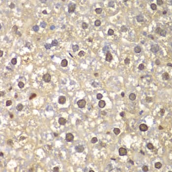 FEN-1 Antibody