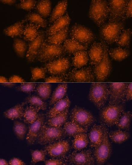 SMYD3 Antibody