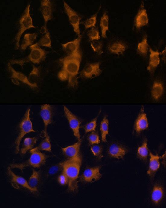 SPRR3 Antibody