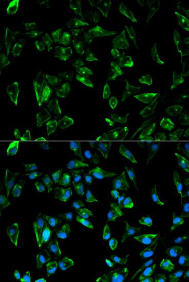 tropomyosin-3 Antibody