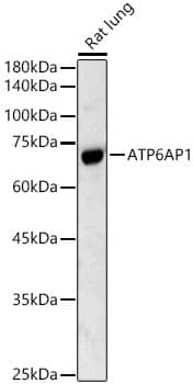 ATP6AP1 Antibody