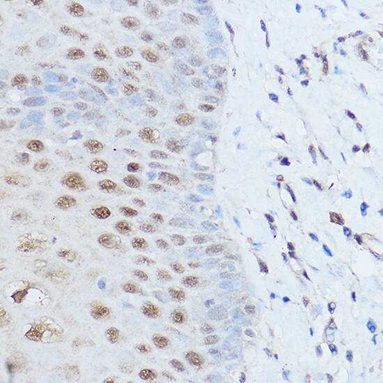 SMARCD2 Antibody