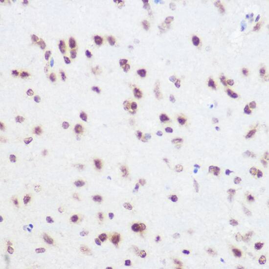 SART3 Antibody