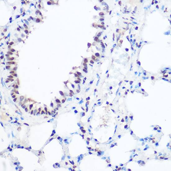 SART3 Antibody