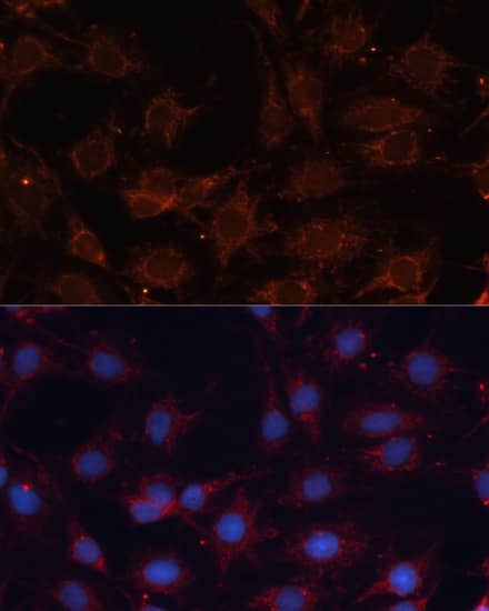 SLC25A24 Antibody