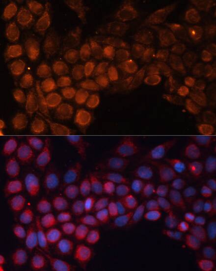 SLC25A24 Antibody