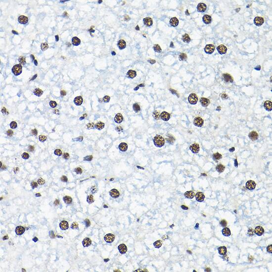 SNRPA1 Antibody