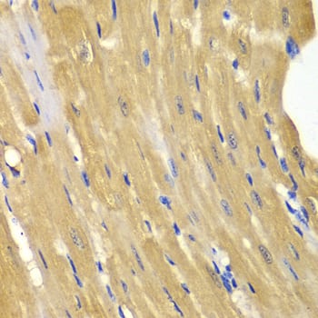 Adenylate Kinase 1 Antibody