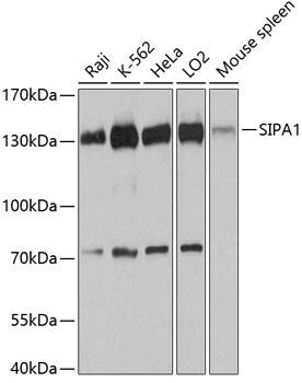 SIPA1 Antibody