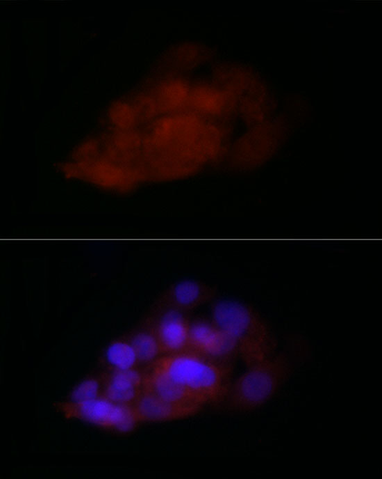 TIA1 Antibody