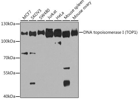 Topoisomerase I Antibody