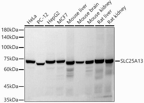 SLC25A13 Antibody