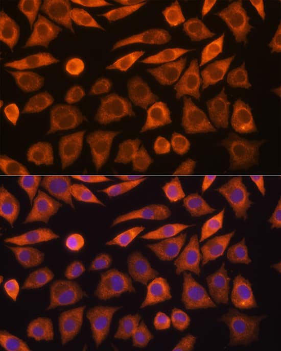 Guanylyl Cyclase alpha 1 Antibody