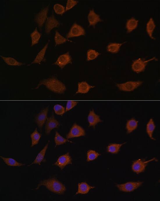 LSM1 Antibody