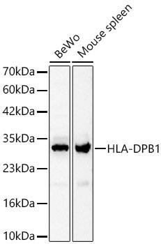 HLA DPB1 Antibody