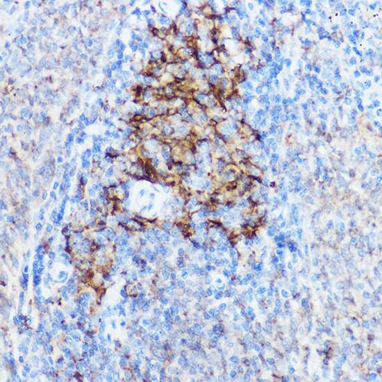 HLA DPB1 Antibody