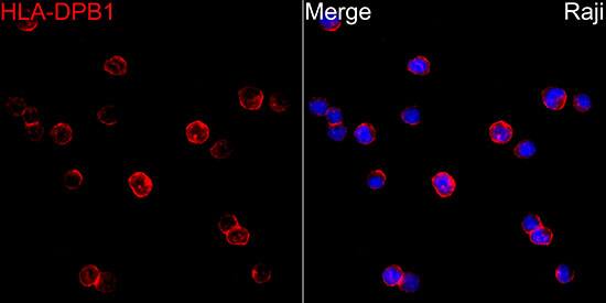 HLA DPB1 Antibody