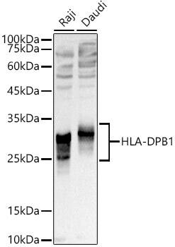 HLA DPB1 Antibody