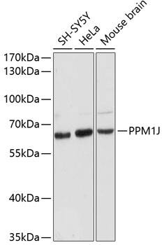 PPM1J Antibody