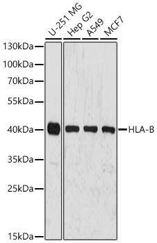 HLA B Antibody