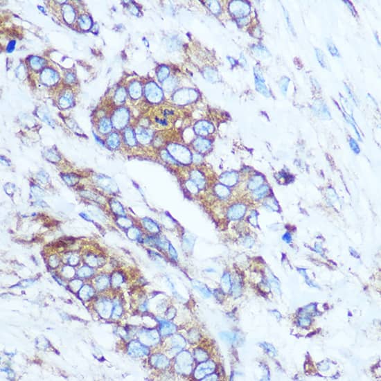 GSTT1 Antibody