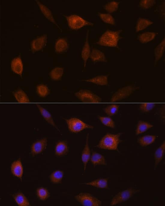 GSTT1 Antibody