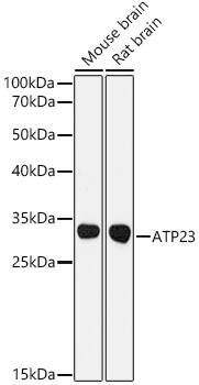 XRCC6BP1 Antibody