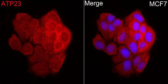 XRCC6BP1 Antibody